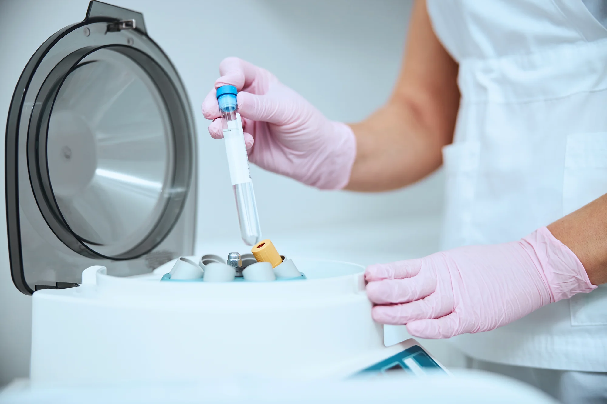 Implant-supported dentures Beaverton - snap-on dentures