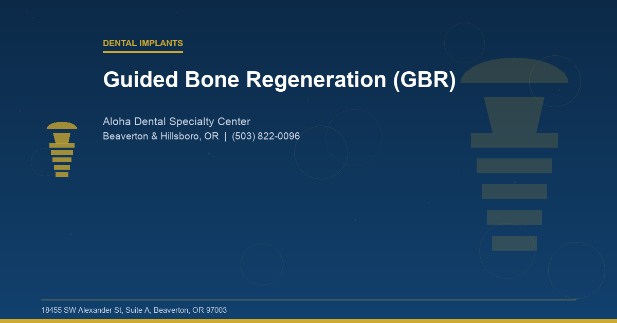 Guided Bone Regeneration (GBR) - Dental Implants at Aloha Dental Specialty Center in Beaverton & Hillsboro, OR