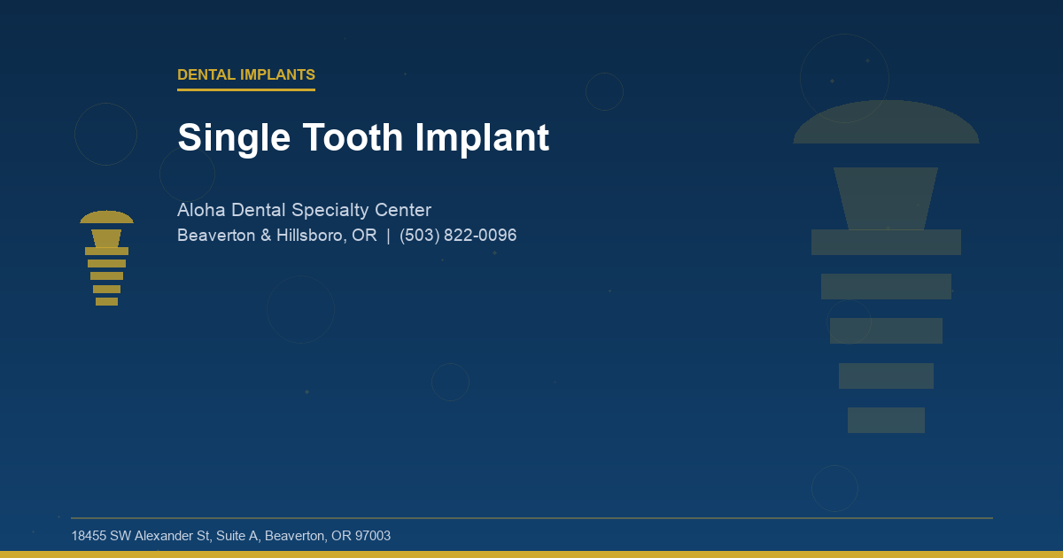 Single Tooth Implant - Dental Implants at Aloha Dental Specialty Center in Beaverton & Hillsboro, OR