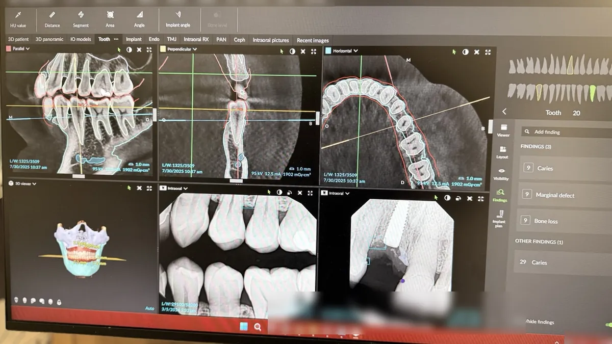 3D CBCT scan on a monitor showing cross-sections of the teeth and jaw